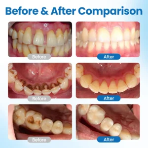 Tiworld® NanoHAP Tooth Defense Serum