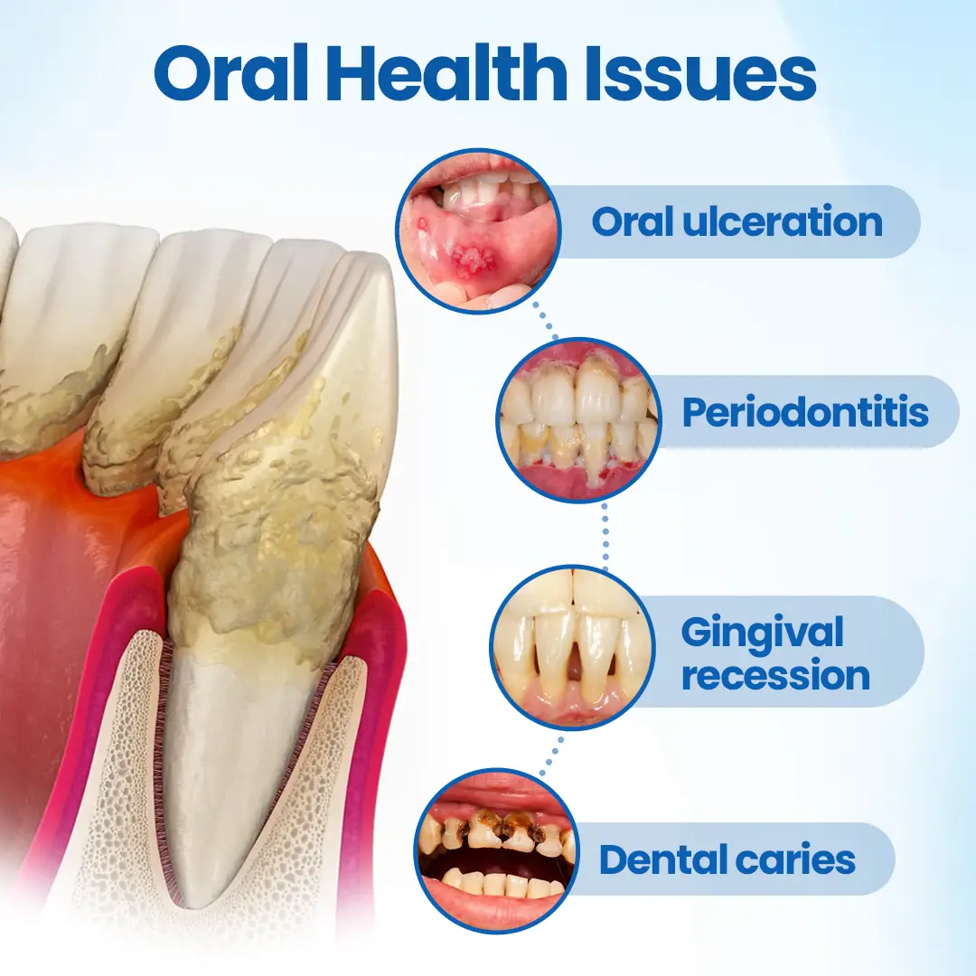 Tiworld® NanoHAP Tooth Defense Serum
