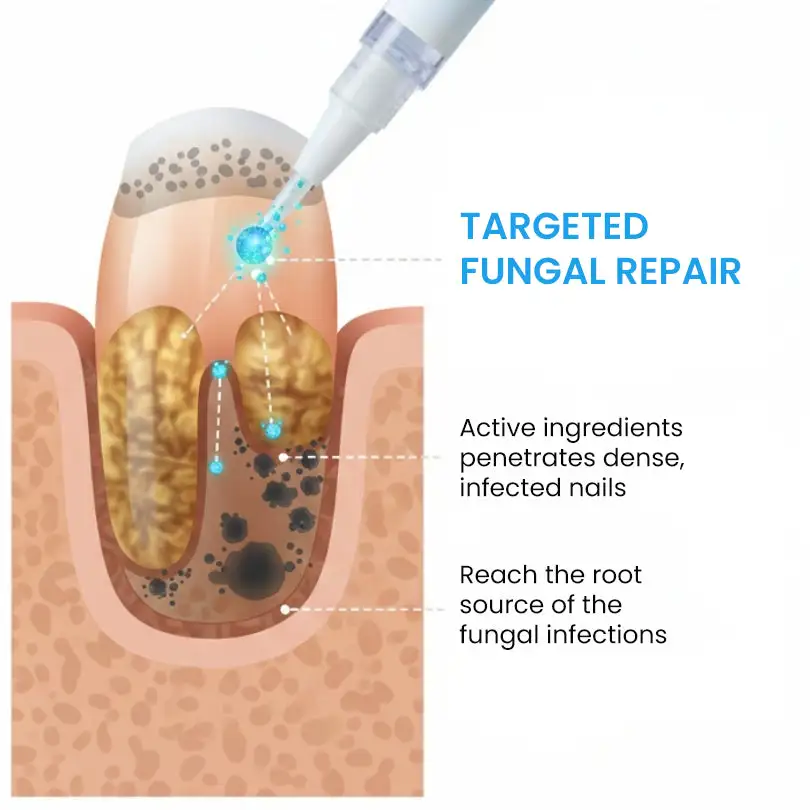 AEXZR® NanoFix Nail Repair Pen