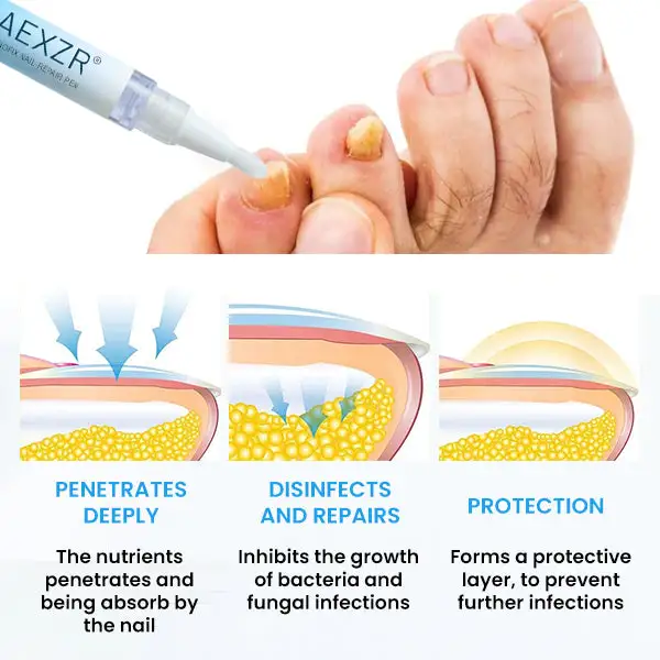 AEXZR® NanoFix Nail Repair Pen