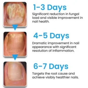 AEXZR® NanoFix Nail Repair Pen