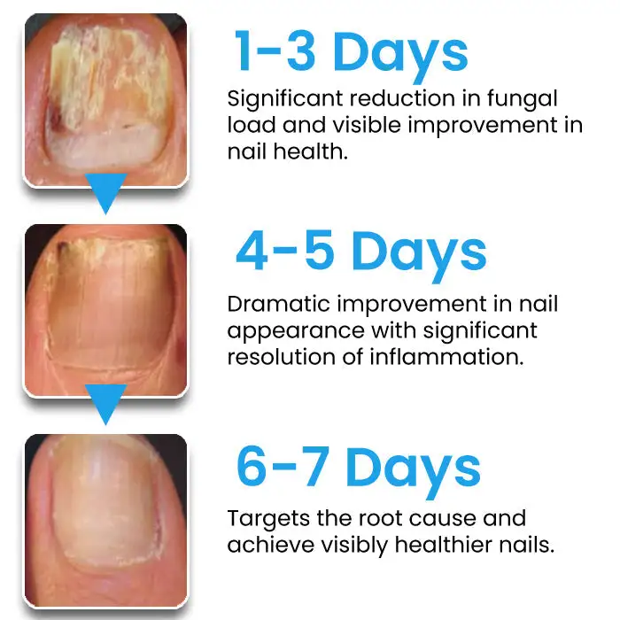 AEXZR® NanoFix Nail Repair Pen