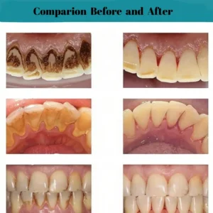 AEXZR® Oral Calculus Suppressant