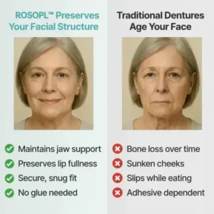 ROSOPL™ Custom-Fit Functional Dentures