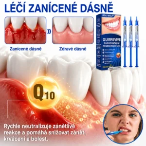👨🏻‍⚕️ 𝐇𝐄𝐀𝐓𝐖𝐎𝐋𝐅® 𝐆𝐮𝐦𝐑𝐞𝐯𝐢𝐯𝐞 𝐩𝐚𝐫𝐨𝐝𝐨𝐧𝐭á𝐥𝐧í 𝐨𝐩𝐫𝐚𝐯𝐧ý 𝐠𝐞𝐥