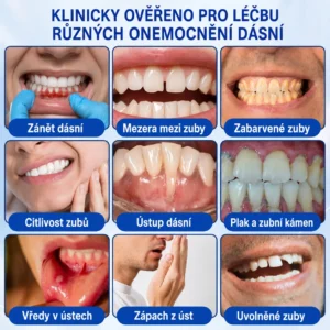 👨🏻‍⚕️ 𝐇𝐄𝐀𝐓𝐖𝐎𝐋𝐅® 𝐆𝐮𝐦𝐑𝐞𝐯𝐢𝐯𝐞 𝐩𝐚𝐫𝐨𝐝𝐨𝐧𝐭á𝐥𝐧í 𝐨𝐩𝐫𝐚𝐯𝐧ý 𝐠𝐞𝐥