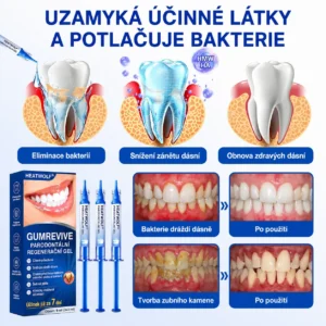 👨🏻⚕️ 𝐇𝐄𝐀𝐓𝐖𝐎𝐋𝐅® 𝐆𝐮𝐦𝐑𝐞𝐯𝐢𝐯𝐞 𝐩𝐚𝐫𝐨𝐝𝐨𝐧𝐭á𝐥𝐧í 𝐨𝐩𝐫𝐚𝐯𝐧ý 𝐠𝐞𝐥