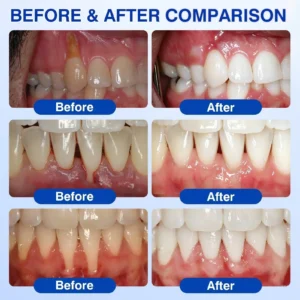 🏅🦷🛡️𝐇𝐄𝐀𝐓𝐖𝐎𝐋𝐅® GumRevive Periodontal Repair Gel